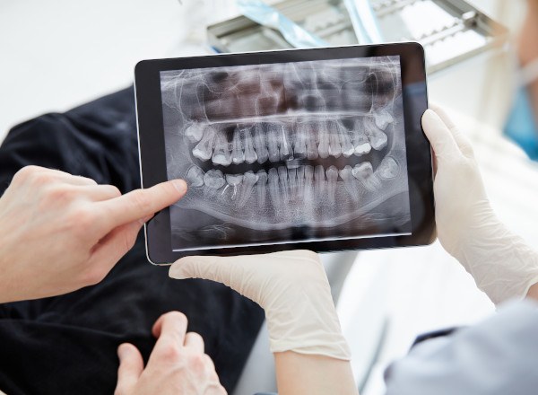 Dentist and patient reviewing X-ray